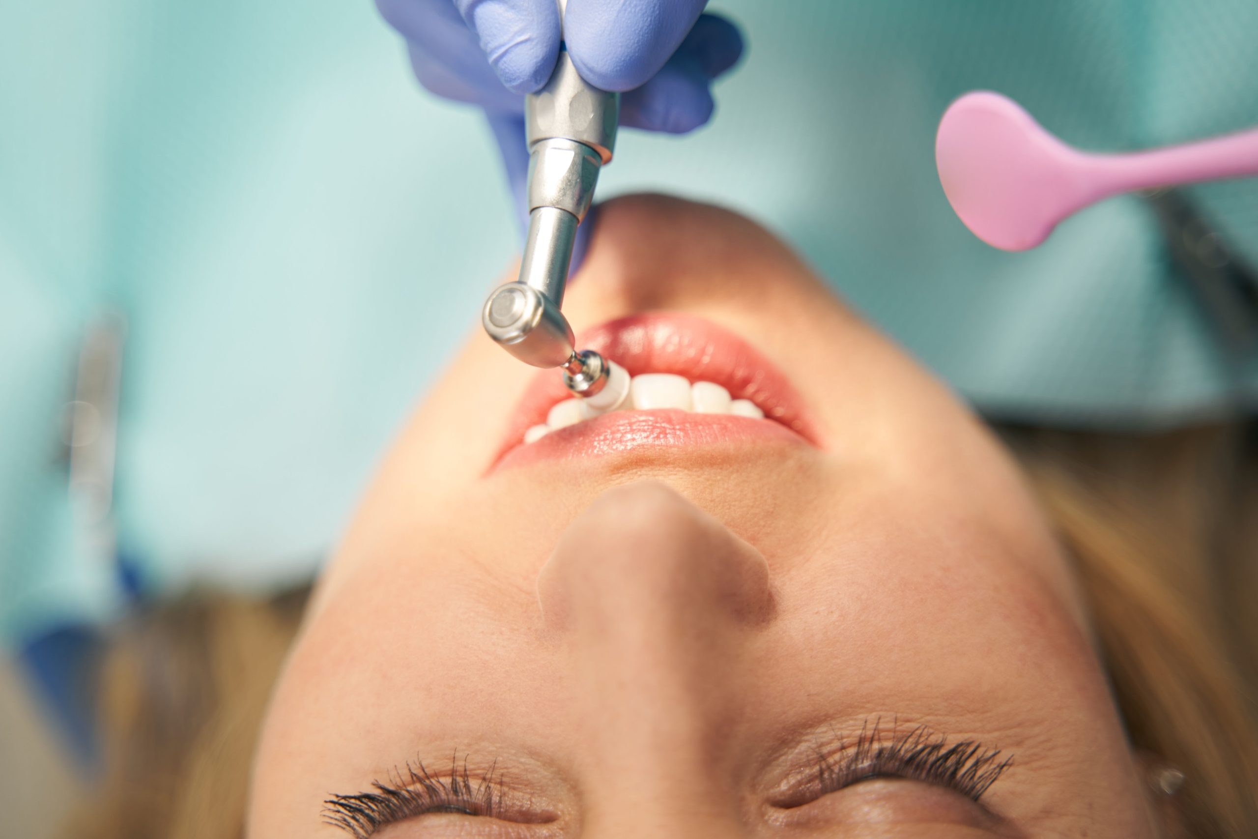 Pain After Dental Cleaning