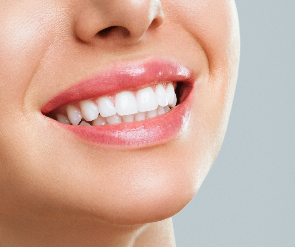 Historical Evolution of Dental Whitening Practices